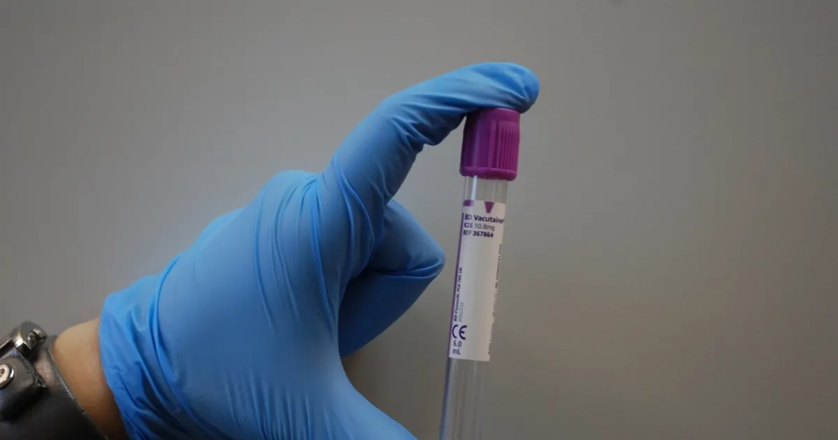 Does CBD show up on a drug test?
